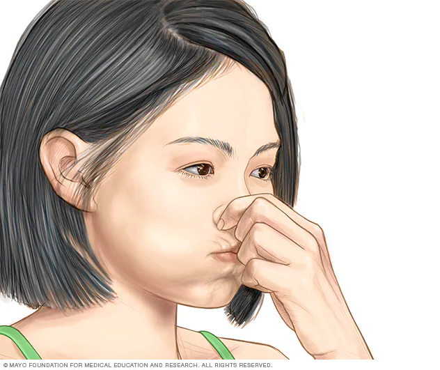 Persona llevando a cabo la maniobra vaslava en la que te suenas la nariz suavemente mientras pellizcas las fosas nasales y mantienes la boca cerrada.